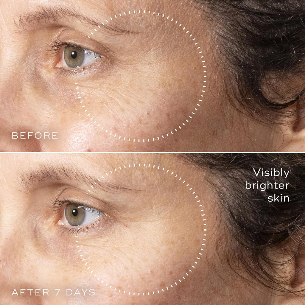 Medik8 C-Tetra Advanced - Balancing, Plumping, Hydrating Daily Vitamin C Serum with Hyaluronic Acid, Squalene - Smooths Fine Lines, Wrinkles - 1.0 oz